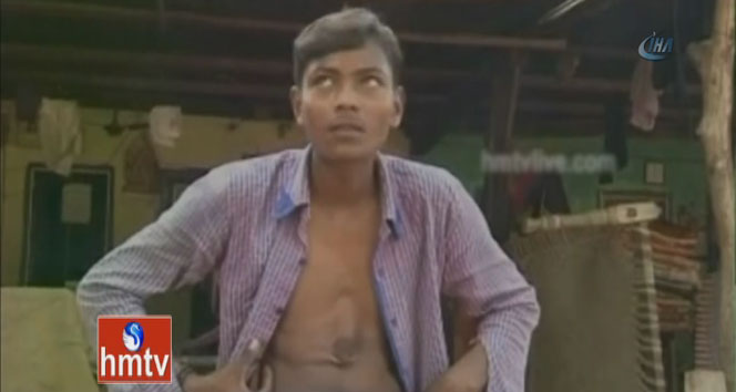 Ölümle burun buruna bir hayat! Kalbi dışarıda atıyor