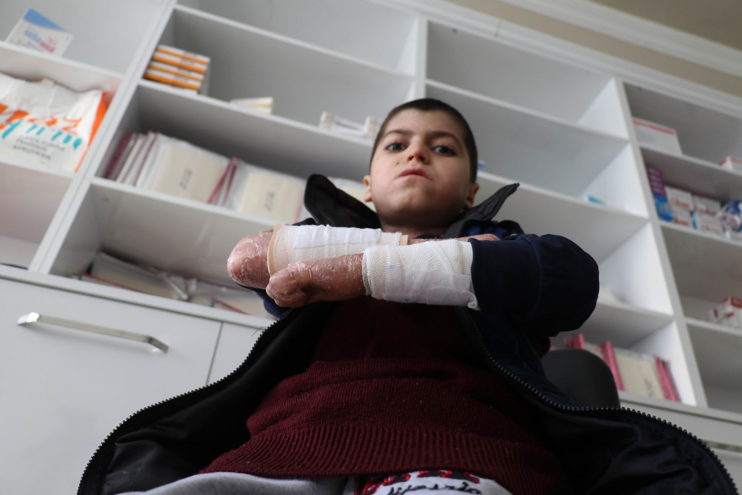 Kelebek hastası çocuklar yetkililerden yardım bekliyor