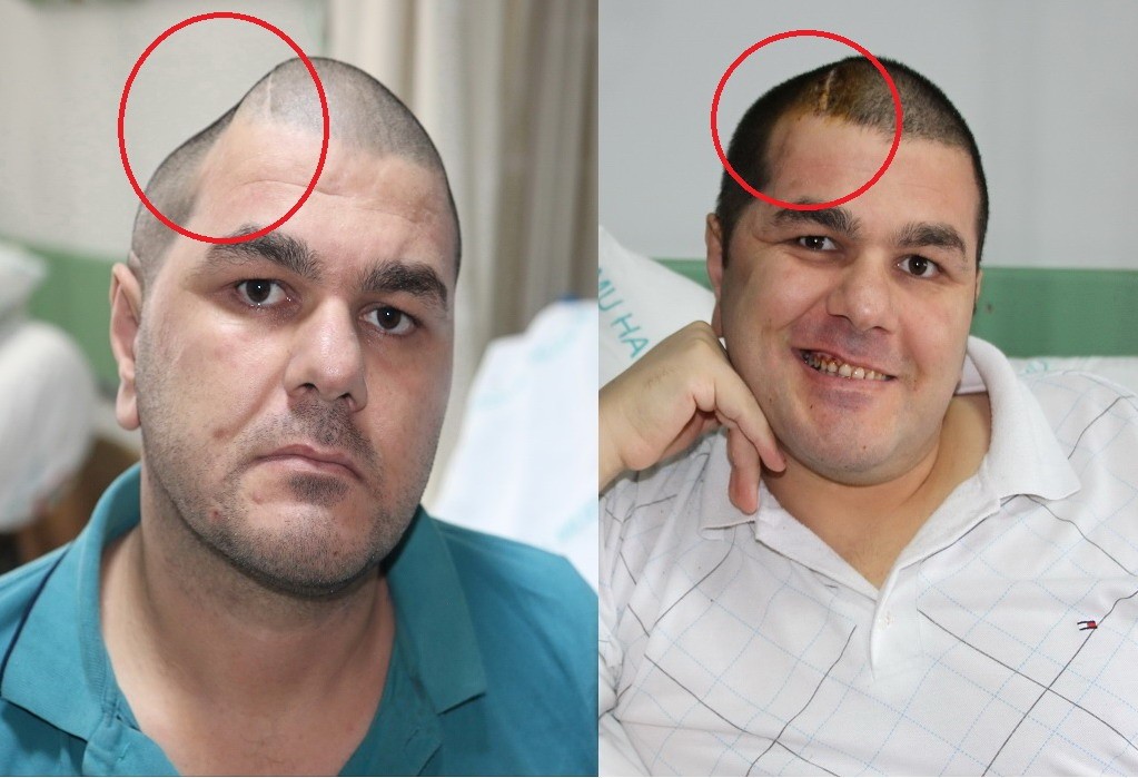 İki fotoğraf arasında inanılmaz fark