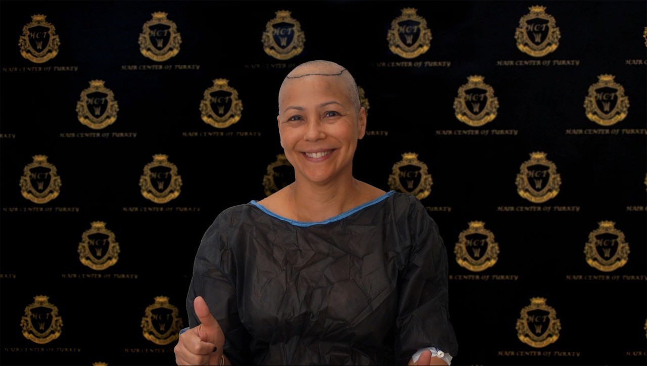 Hair Center of Turkey kadınlarda saç dökülmesine noktayı koyuyor