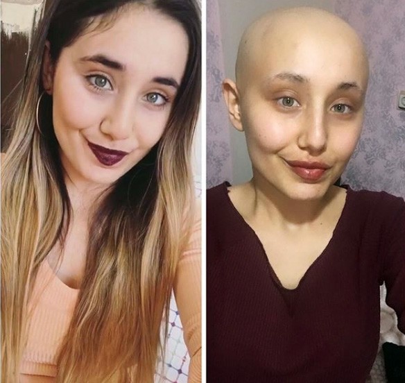 İkinci kez kansere yakalanan Ayyüce hayatını kaybetti