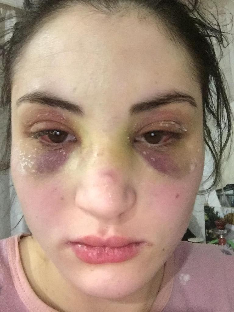 Kaçarak evlendiği eşi, genç kadına kabusu yaşattı