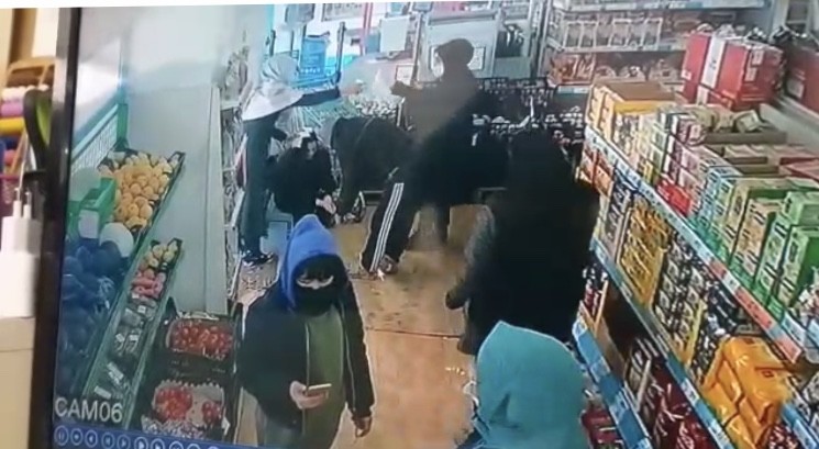 Pitbull saldırısına uğrayan küçük kızın babası dehşet dolu anları anlattı