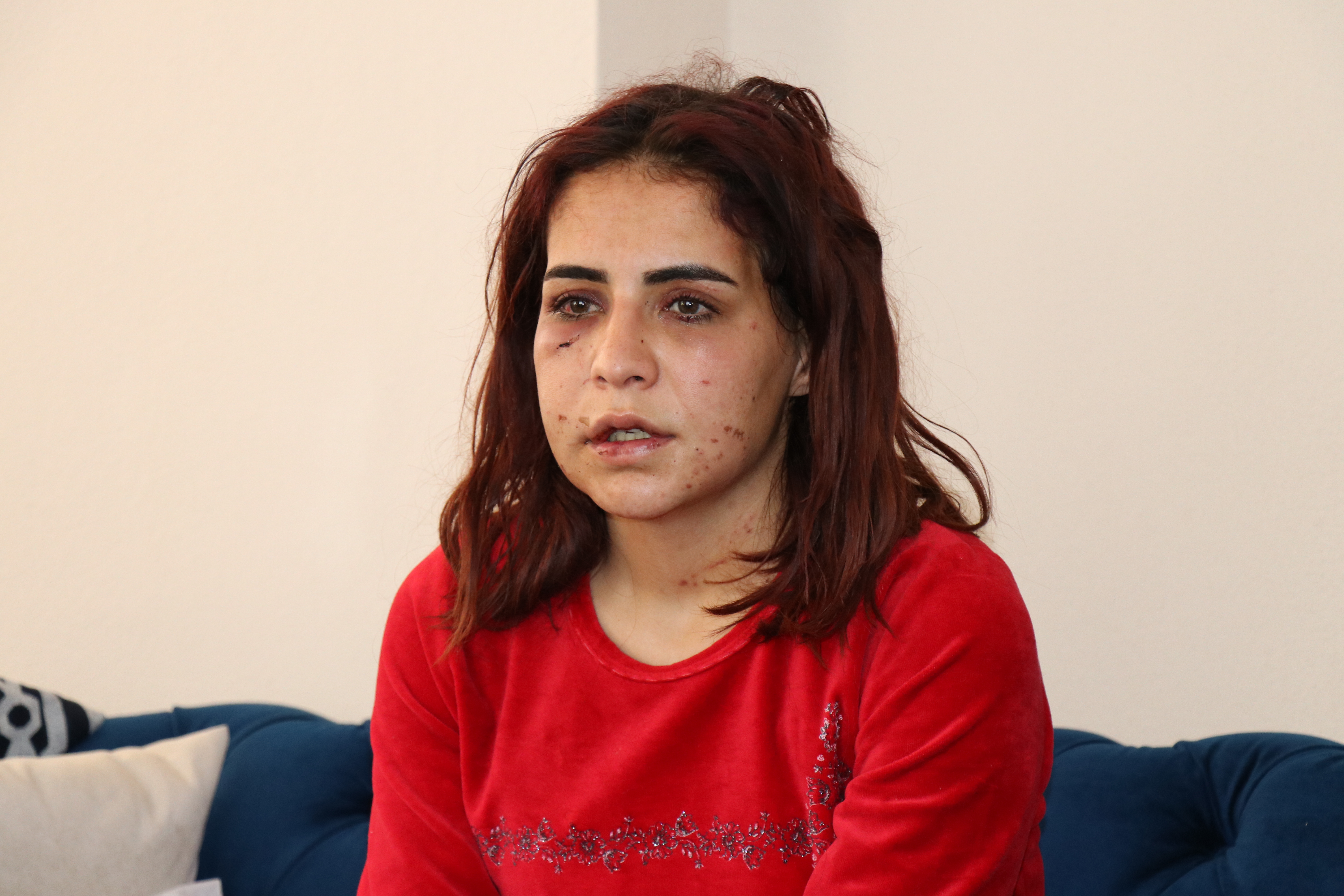 Sevgilisi tarafından darp edilen Beyza: “Başkaları gibi ölmek istemiyorum”