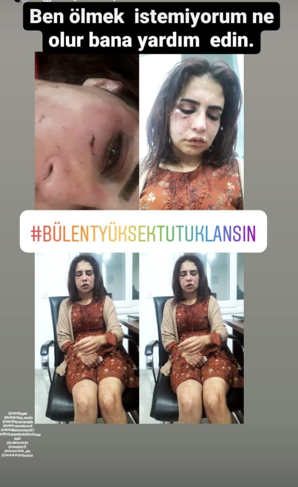 Sevgilisi tarafından darp edilen Beyza: “Başkaları gibi ölmek istemiyorum”