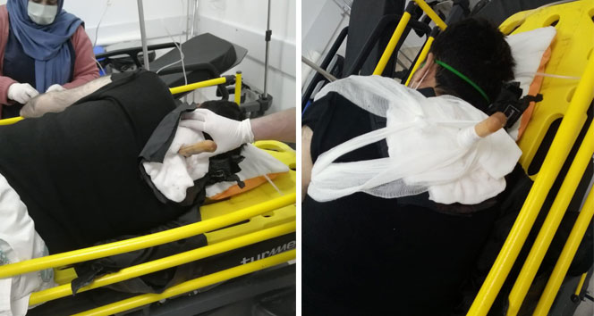 Kaldırımda yürürken dehşeti yaşadı, sırtındaki bıçakla hastaneye kaldırıldı