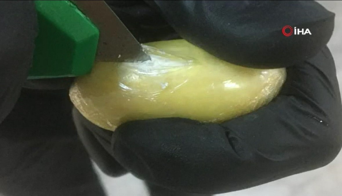 İstanbul Havalimanı'nda yolcunun midesinde 2 kilo uyuşturucu çıktı