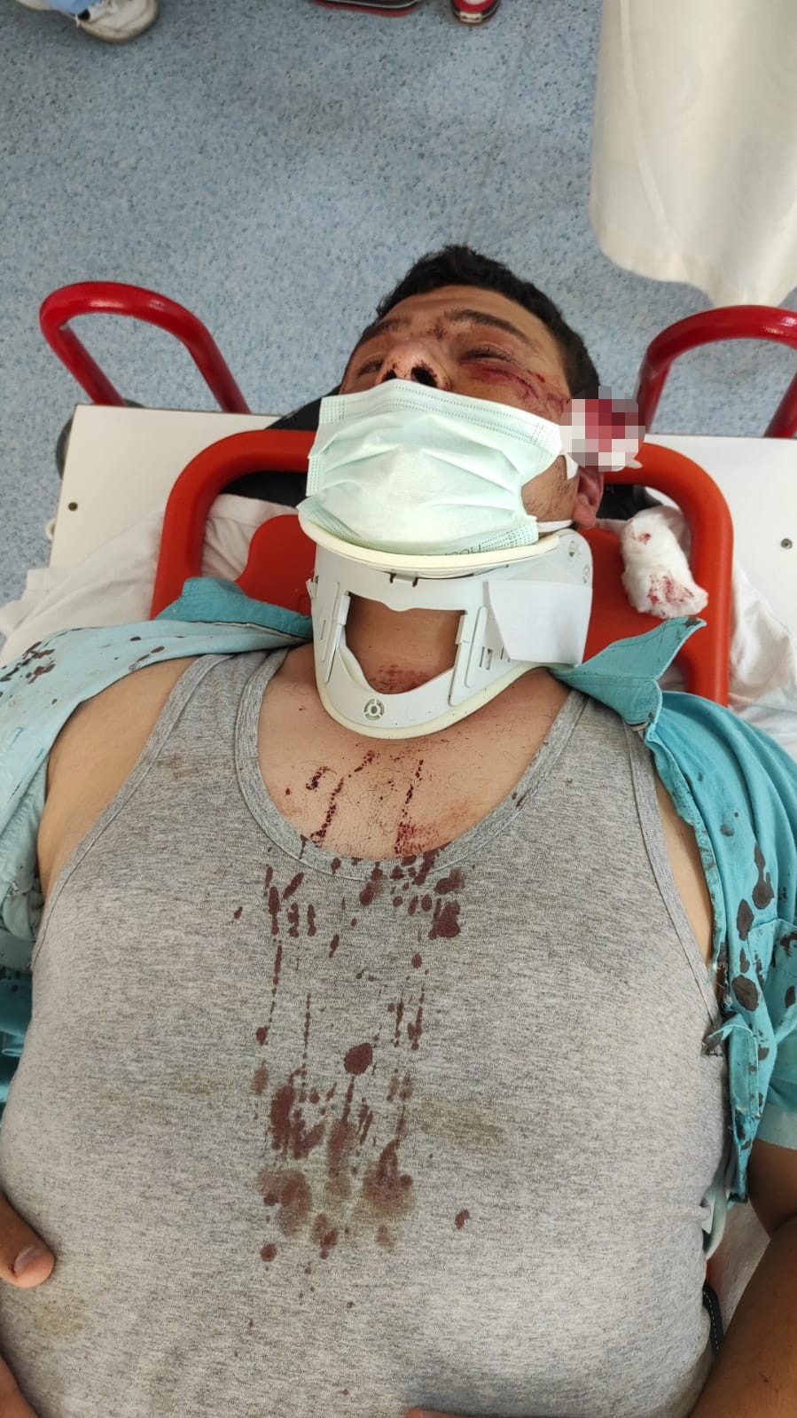 İHA muhabirini darp eden saldırganlardan biri Türkkan’ın yeğeni çıktı!