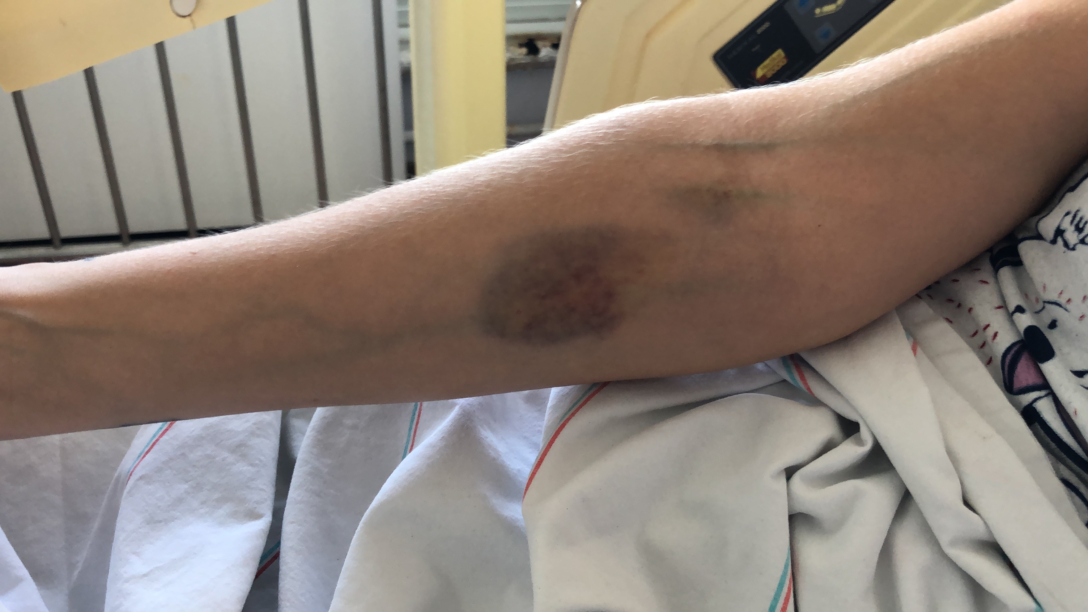 Eski eşi tarafından öldürülesiye darp edilen kadın konuştu: 'Sesimi duysunlar'