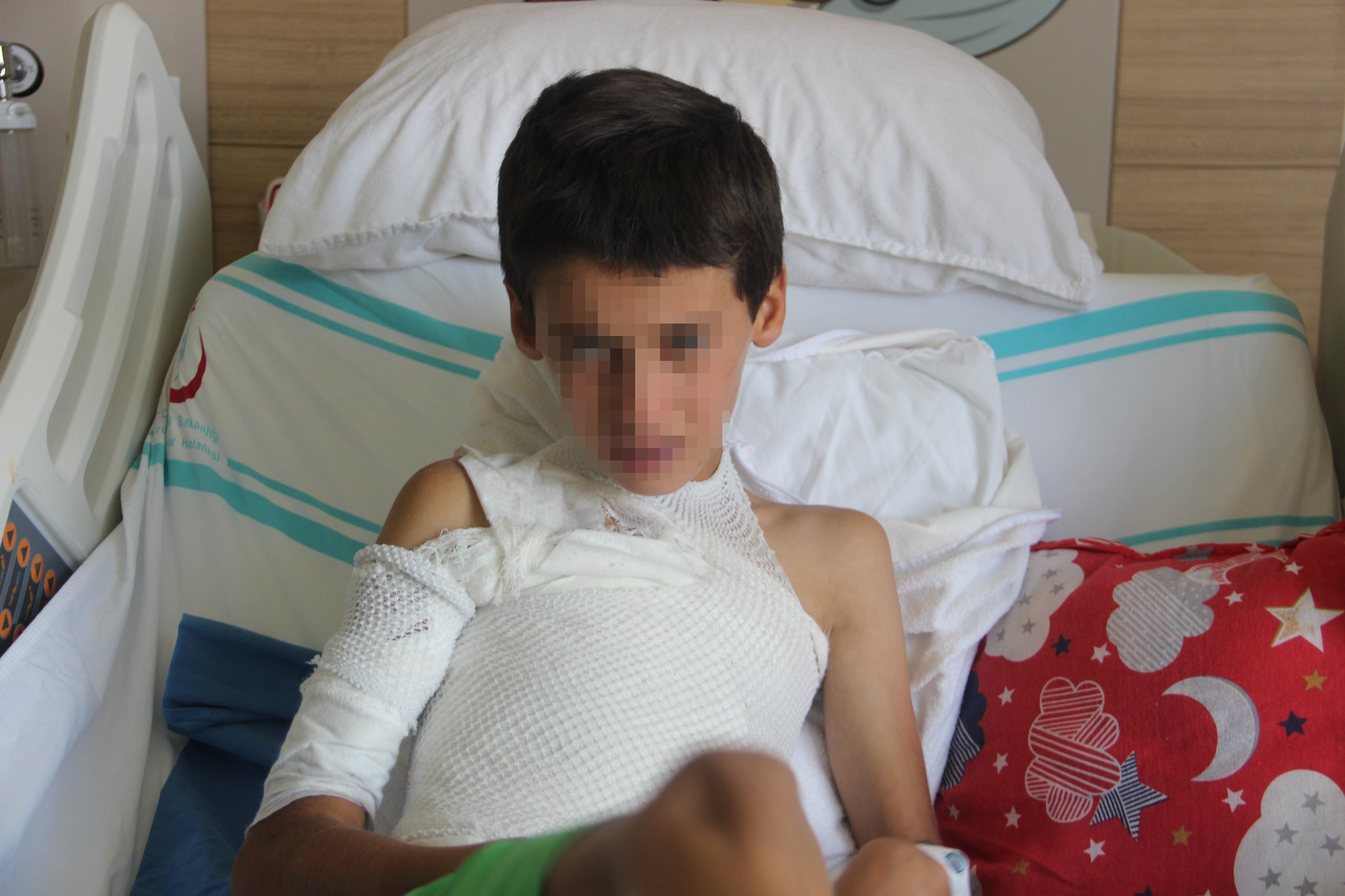 Sosyal medyadan görüp üzerine kolonya döktüğü ikizini yaktı