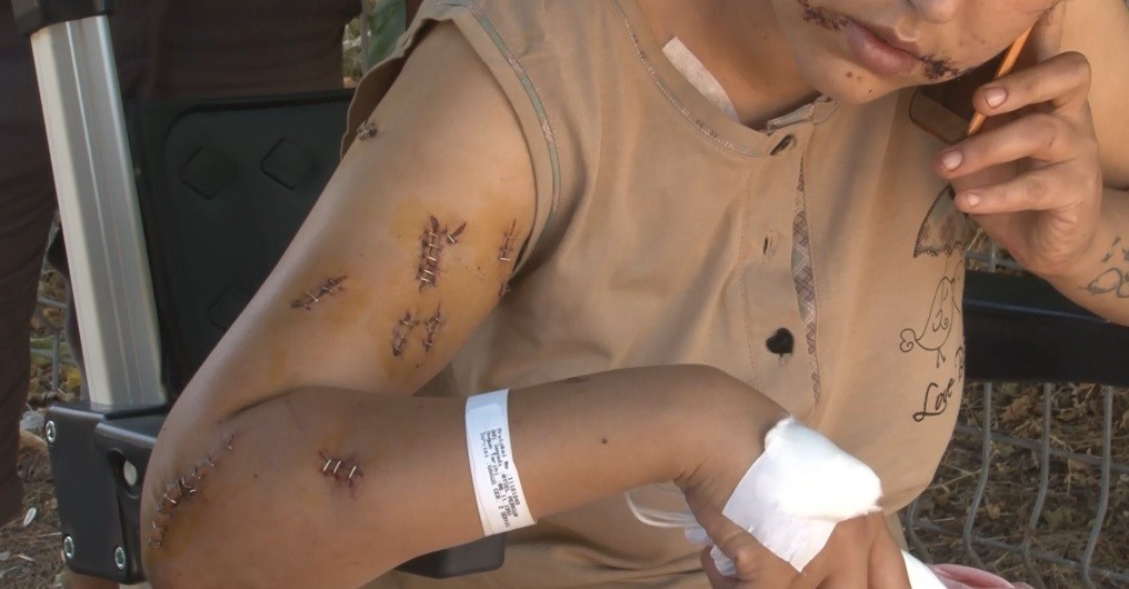 Eşini 104 yerinden bıçaklayan sanığa 20 yıl hapis talebi