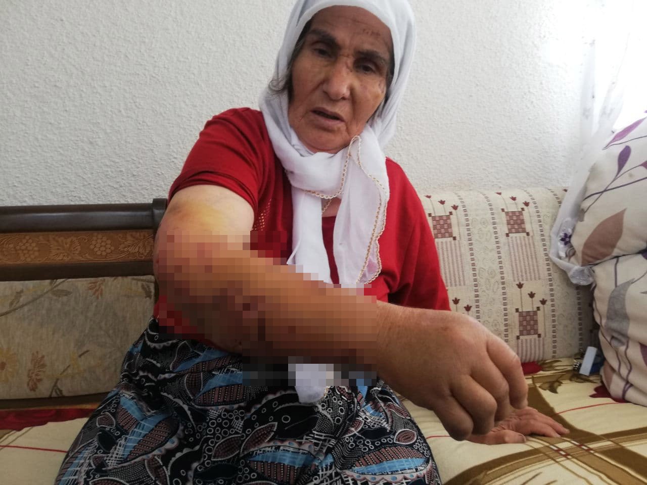 Köpeğin saldırısına uğrayan kadın ölümden döndü