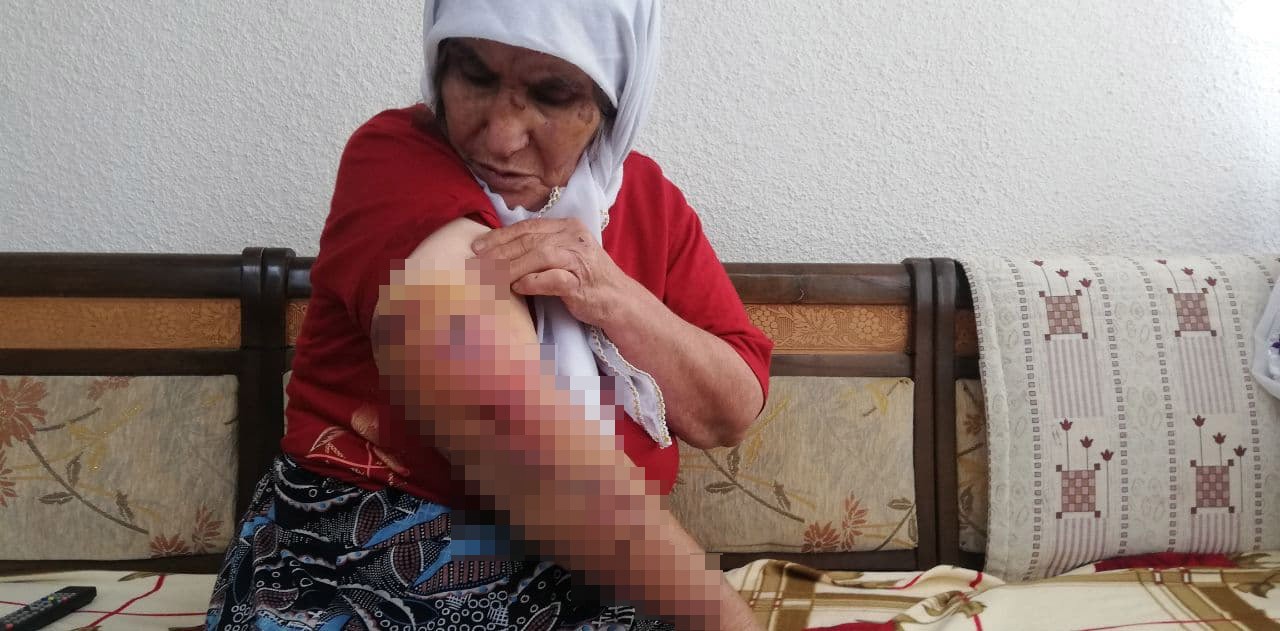 Köpeğin saldırısına uğrayan kadın ölümden döndü