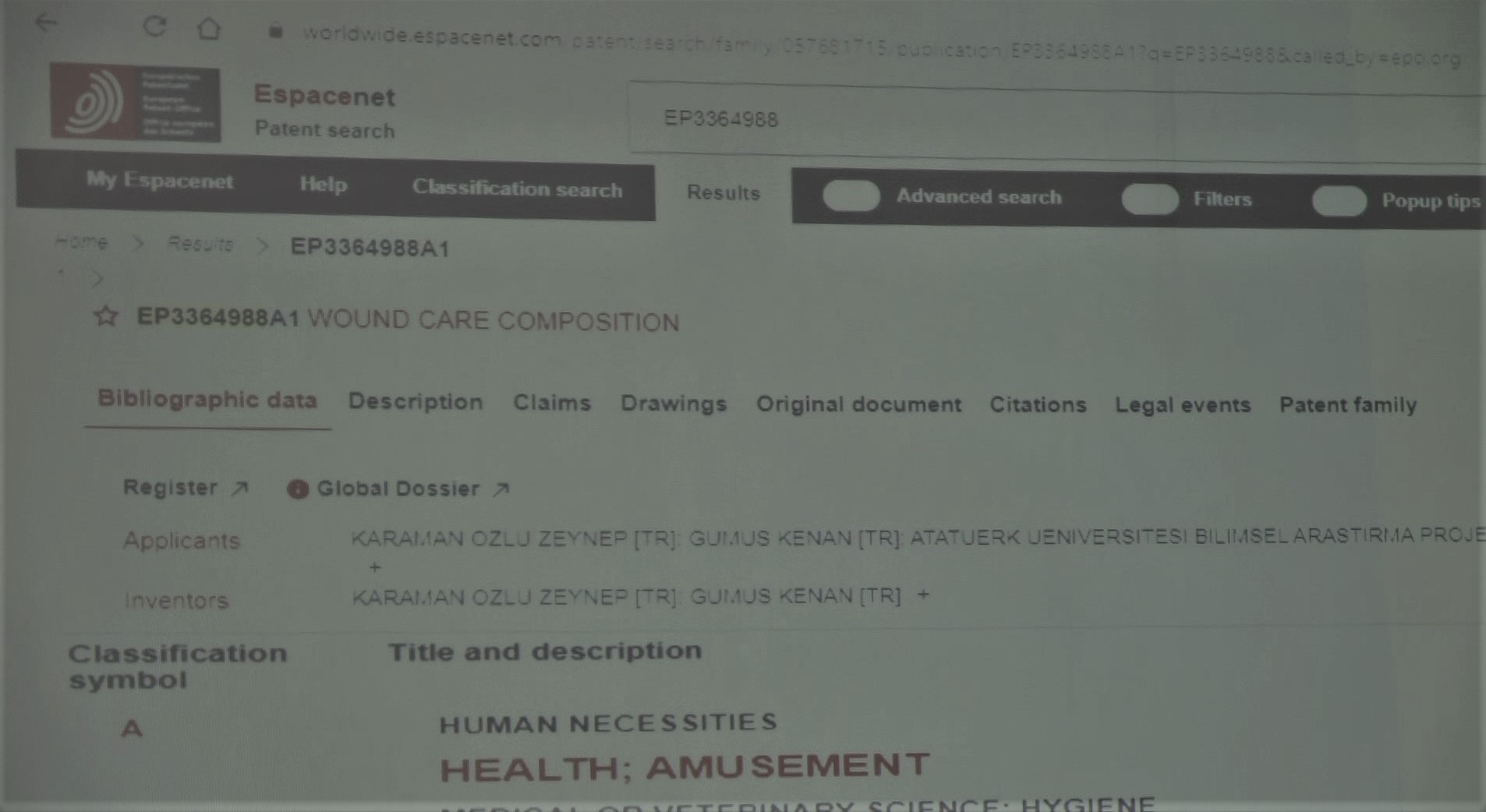 Yanık tedavisinde umut olacak çalışmaya Avrupa’dan patent