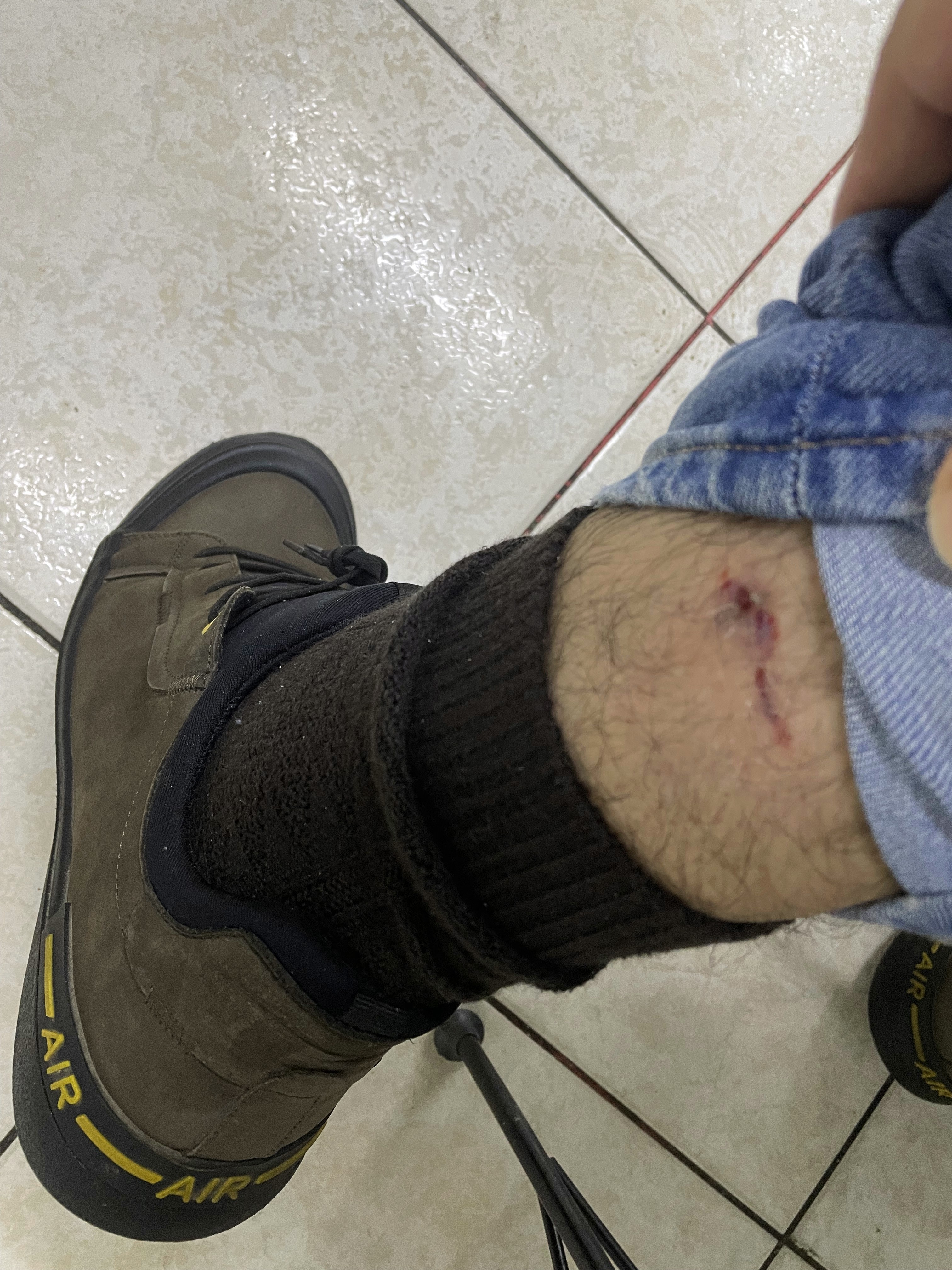 İşe gitmek için evinden çıktı, 4 tane köpeğin saldırısına uğradı