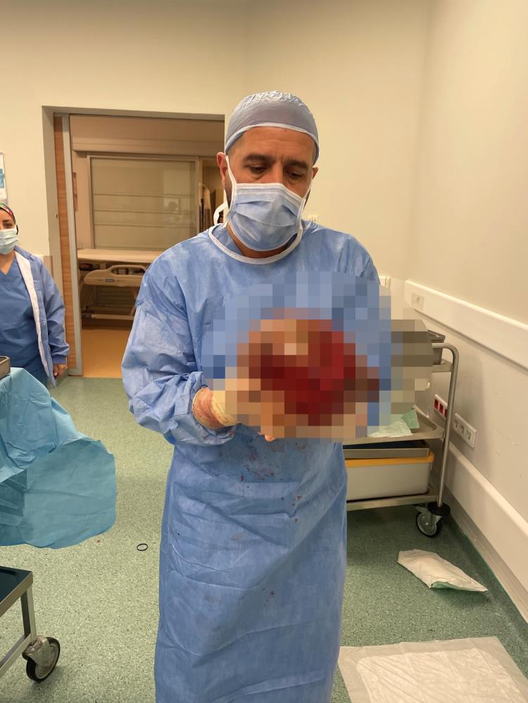 Karın ağrısı ve şişkinlik şikâyetiyle hastaneye gitti, gerçeği öğrenince şoke oldu