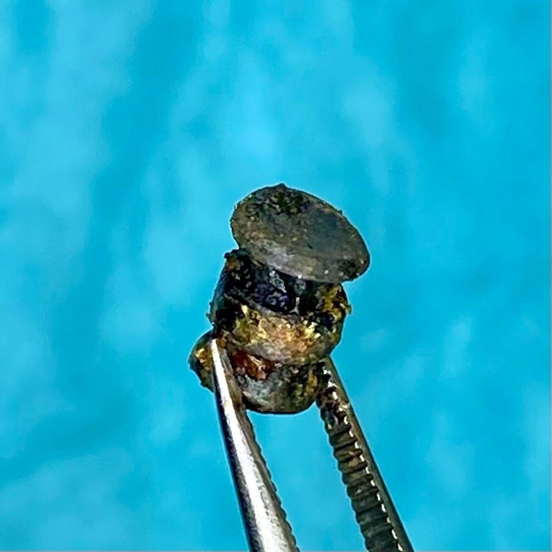 Damağına saplanan kurşun büyüklüğündeki demir parçasından 15 yıl sonra haberdar oldu