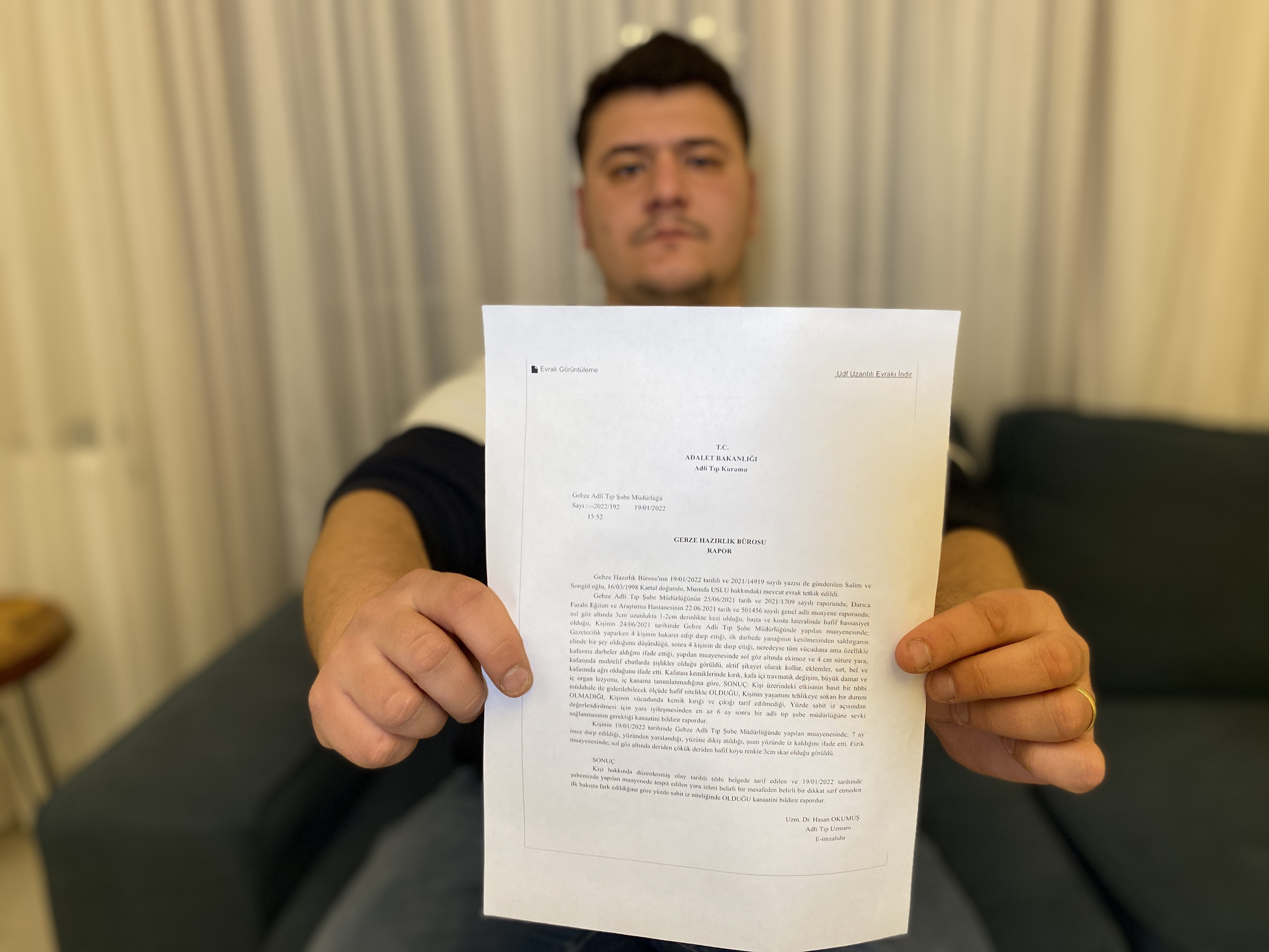 Lütfü Türkkan'ın adamlarının darp ettiği muhabirimizin yüzündeki iz bir ömür kalacak