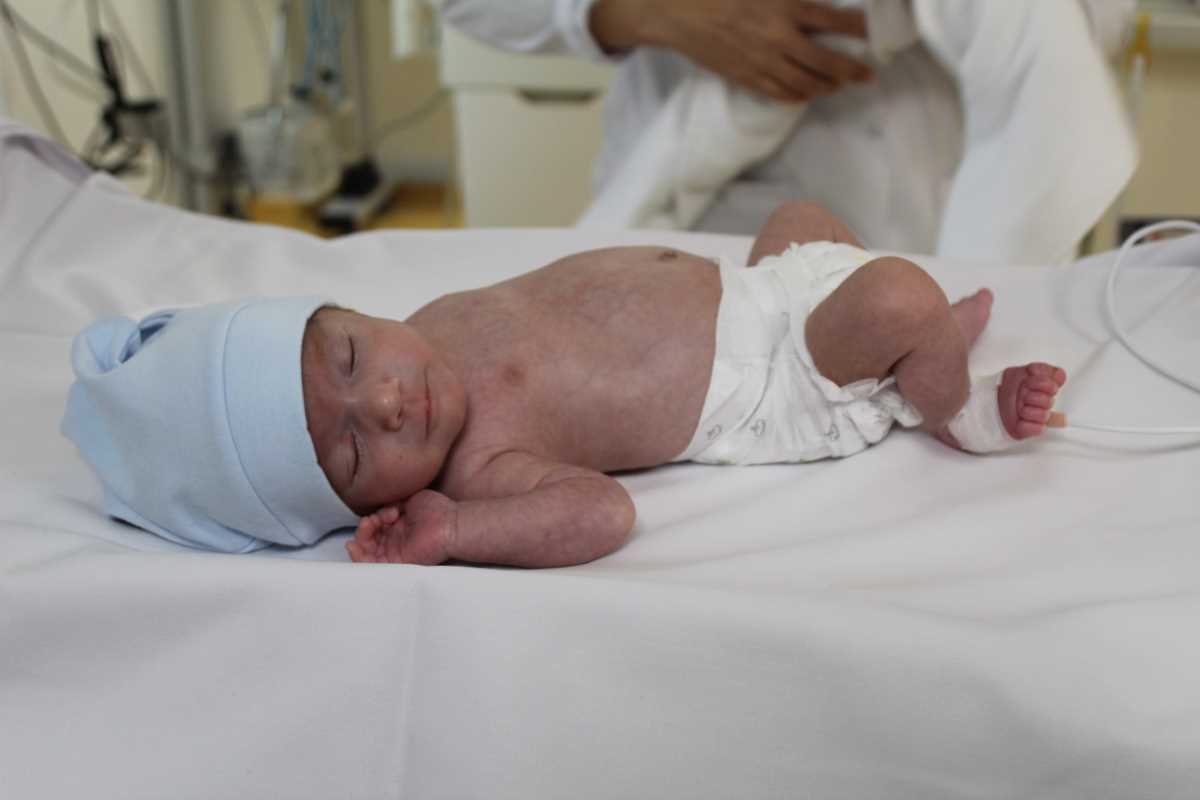 1 kilo 300 gramlık Ayaz dört elle hayata sarıldı