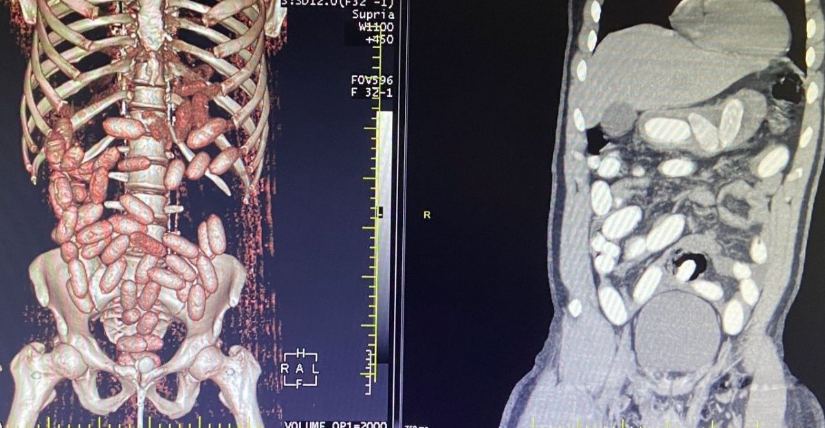 İstanbul Havalimanı’nda uyuşturucu operasyonu