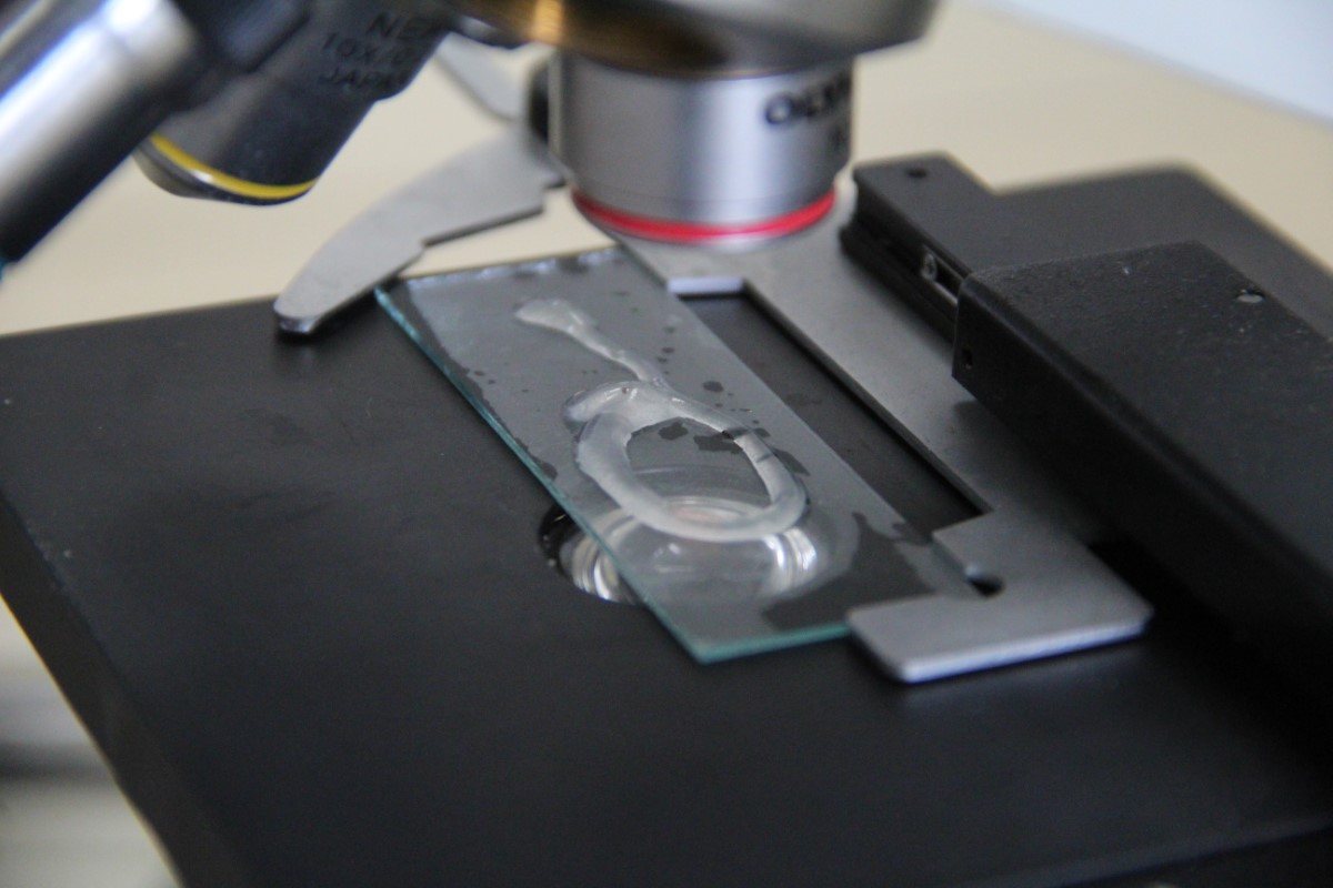 Antalya kıyılarındaki göçmen denizanaları sualtında yakından görüntülendi