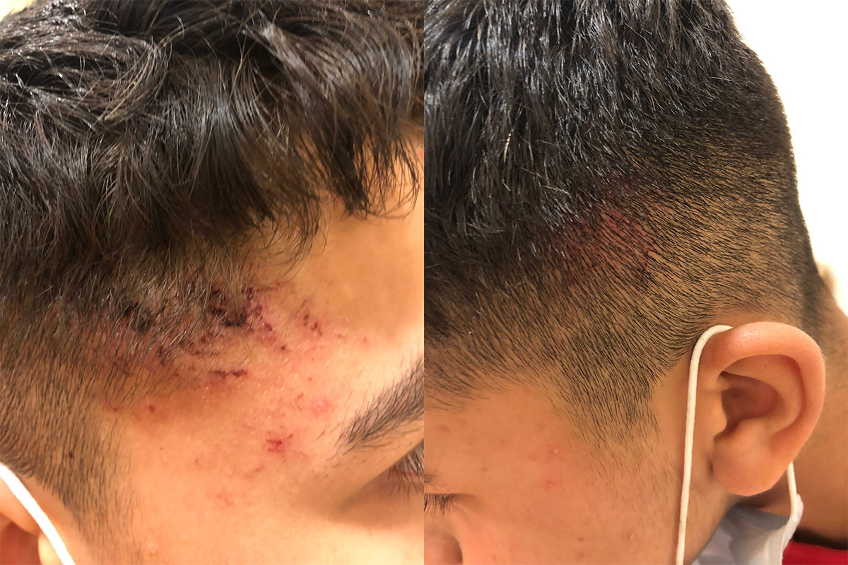 Almanya’da 13 yaşındaki Emirhan Altıntaş’a polis şiddeti kamerada