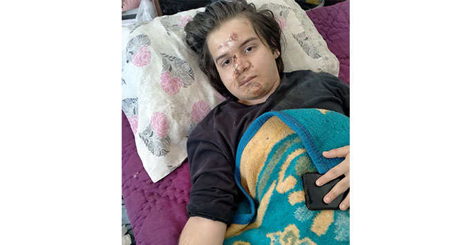 Antalya'da ters yönden yola çıkan ticari taksi motosiklet sürücüsünün ölümle burun buruna getirdi