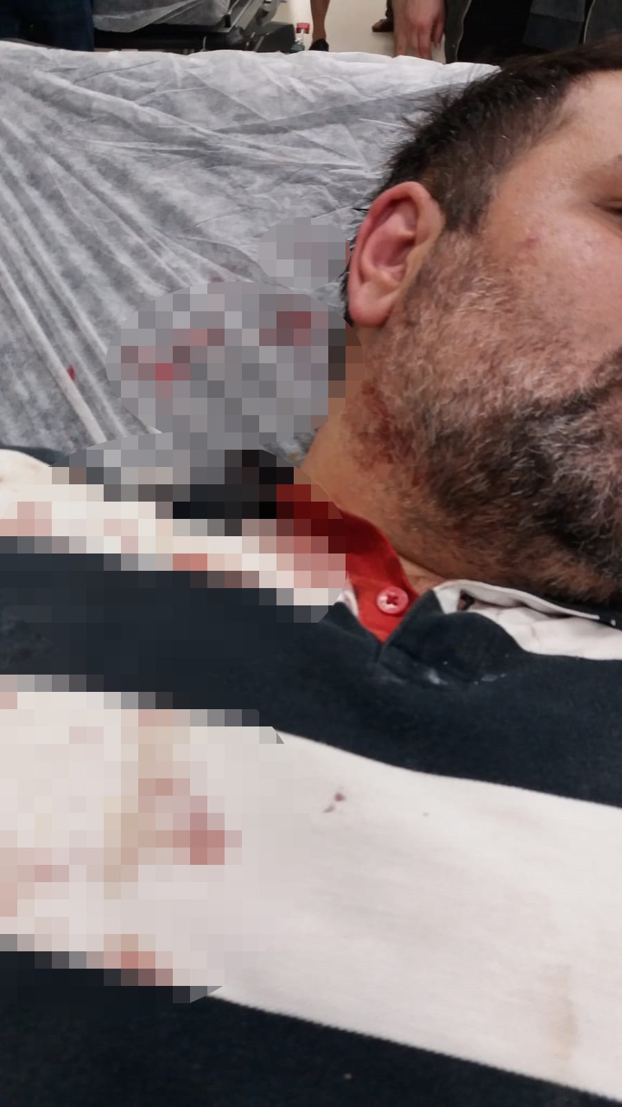 Büyükada’da kaçak inşaatı görüntülemek isteyen gazeteciye kazma kürek ile saldırdılar