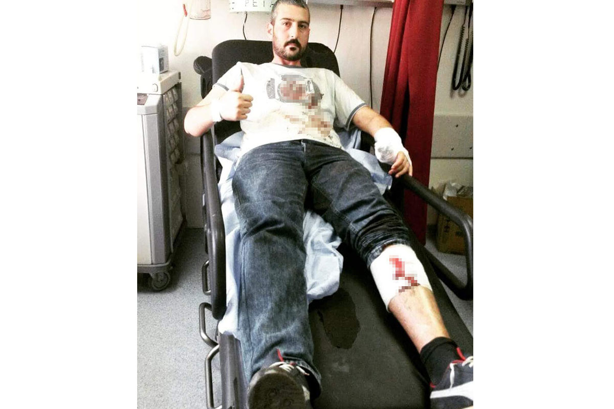 6 yıldır vatan uğruna vücuduna isabet eden şarapnel parçalarıyla yaşıyor