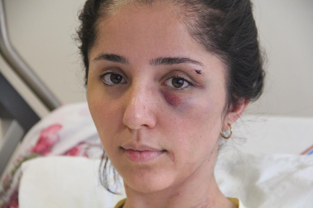 Doktor sevgilisinin evinde dehşeti yaşayan genç kadın 2 saat boyunca darp edildi, 5 yerinden bıçaklandı