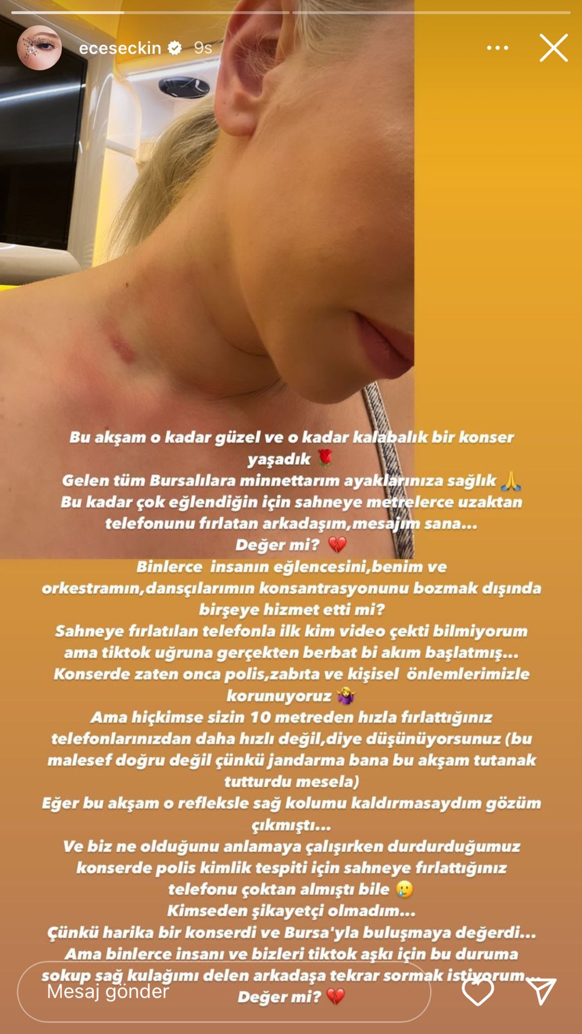 Ece Seçkin’e Bursa’da şok