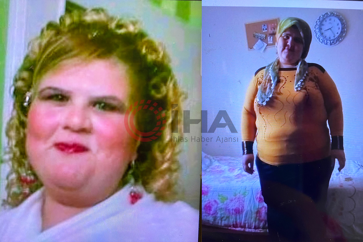 Zayıflamak için internetten ilaç aldı, 350 kiloyu aştı: 'Ben yandım kimse yanmasın'