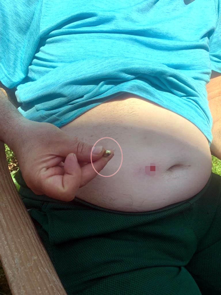 Bahçede bayram kahvaltısı yaparken dehşeti yaşadılar