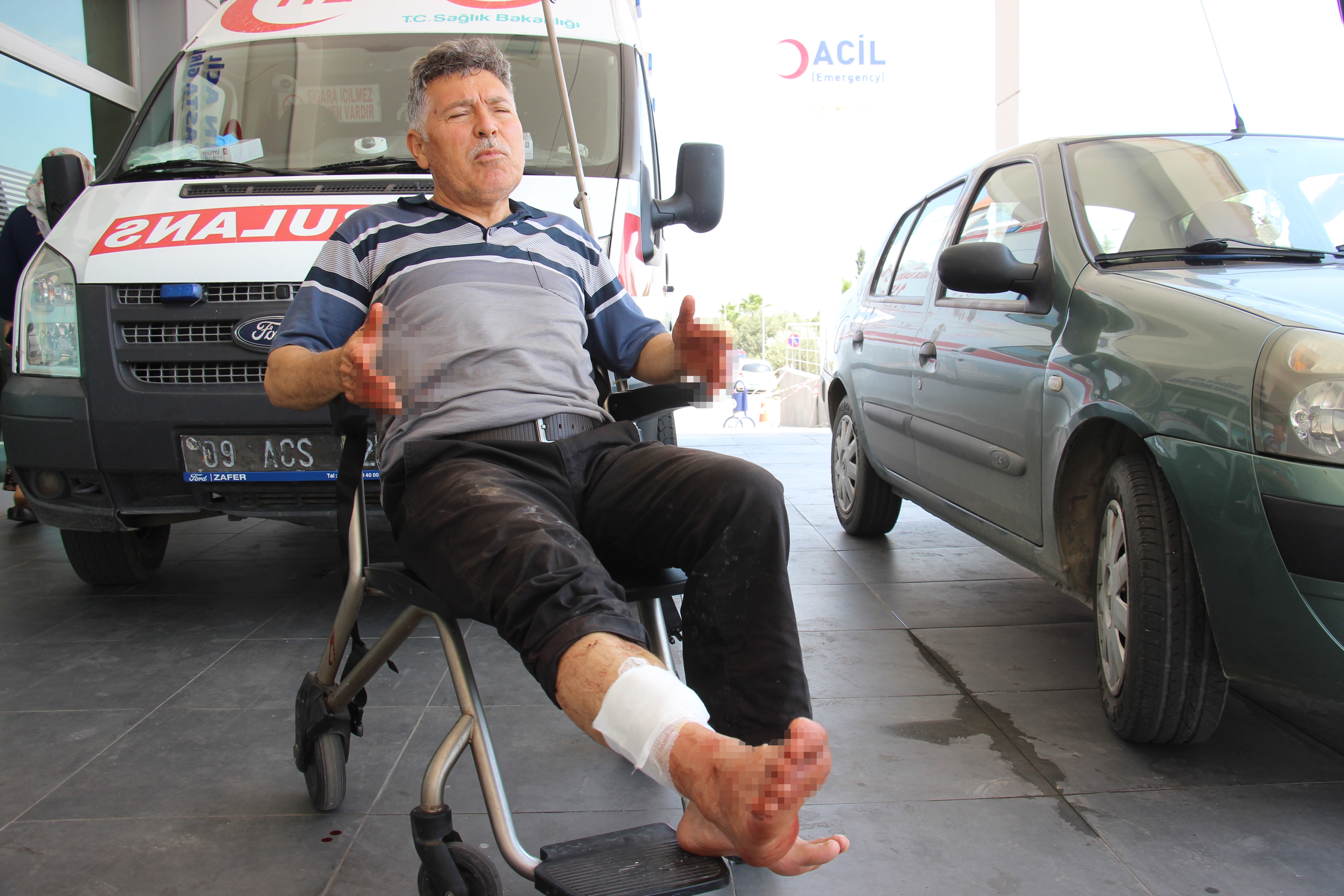 Acemi kasap hastanelik oldu: 