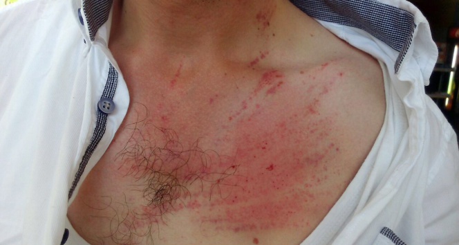 Emniyet amiri polisi dövdü iddiası İzmir,polisi dövdü