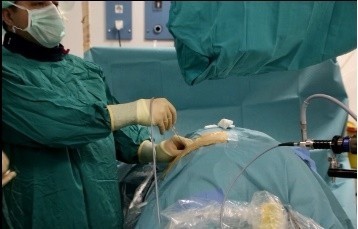 Er Hastaneleri roloji Klinii Trkiye'de Az Sayda Merkezde Uygulanan Kapal Bbrek Ta Ameliyat Yntemini Daha Da Gelitirdi