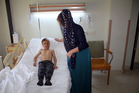 DÄ±ÅarÄ±ya Ã§Ä±kÄ±nca Ã§ocuklar korkuyordu, ameliyat edildi!
