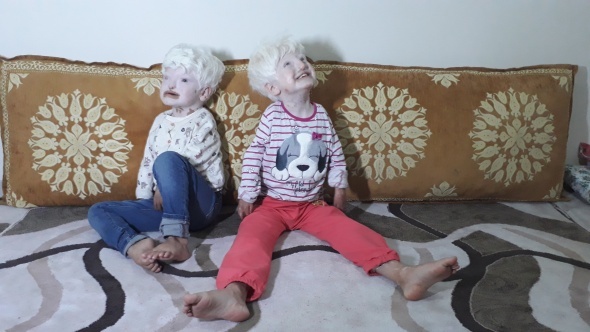 Albino kardeÅler yardÄ±m bekliyor | Albino hastalÄ±ÄÄ± nedir?